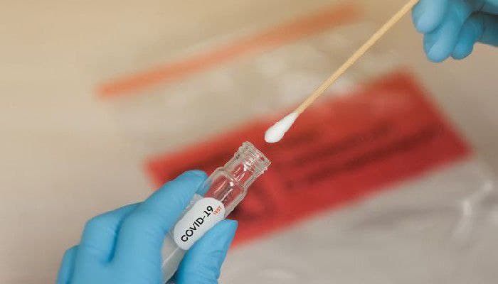rapid test antigen